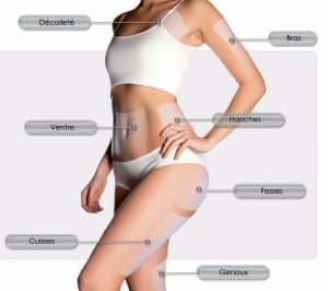 appareil esthétique, lipolyse ultrasonique non invasive paris,minceur, anti-âge, technologie, Paris